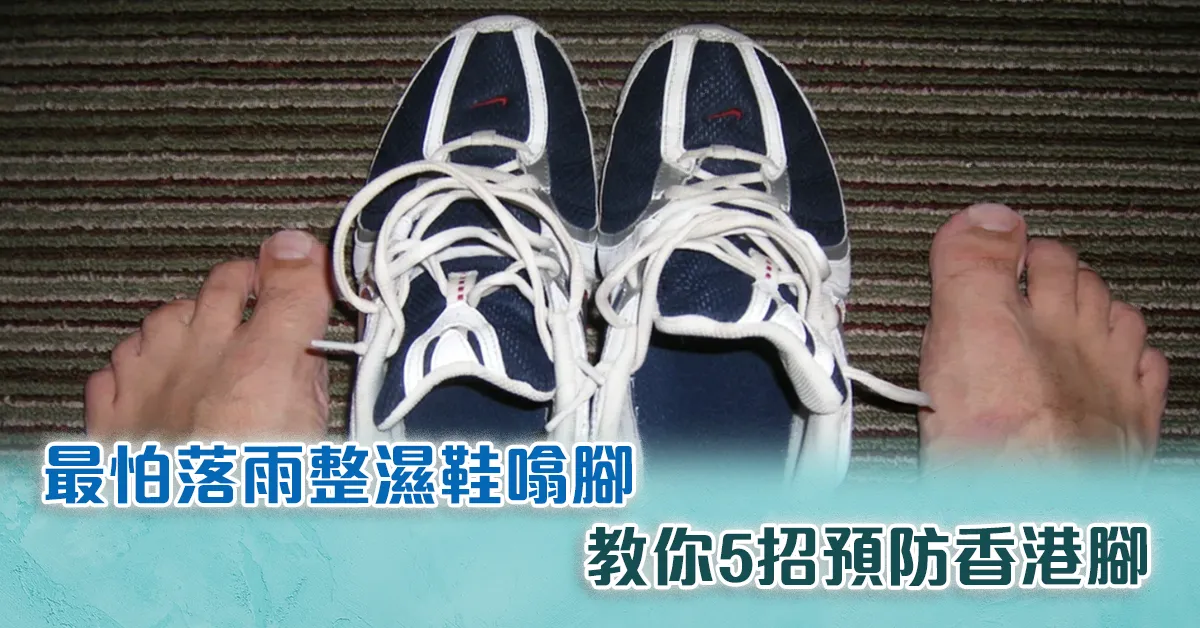 【打工仔健康】最怕落雨整濕鞋噏腳  教你5招預防香港腳 【打工仔健康】最怕落雨整濕鞋噏腳  教你5招預防香港腳